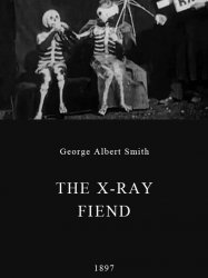 The X-Ray Fiend